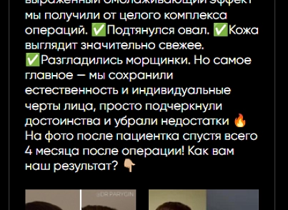 44labs: Posts from VK (s44labs.vkposts) - solution for Bitrix